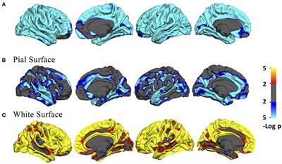 Differential Patterns of Gyral and Sulcal Morphological Changes During Normal Aging Process